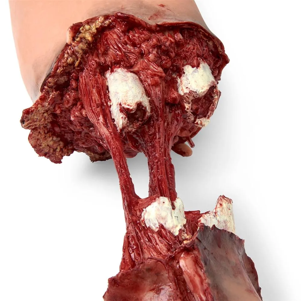 Trauma Bleeding Leg for SMART STAT